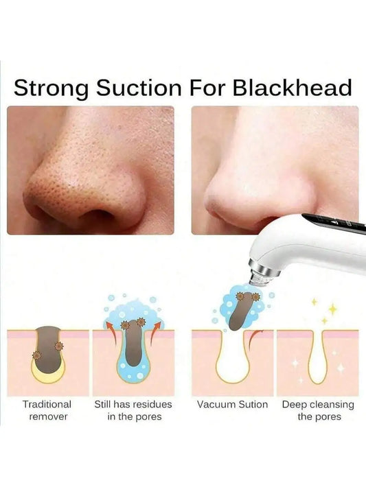 Blackhead remover, pore vacuum facial cleaner, electric acne remover, blackhead remover, USB charging water circulation facial c