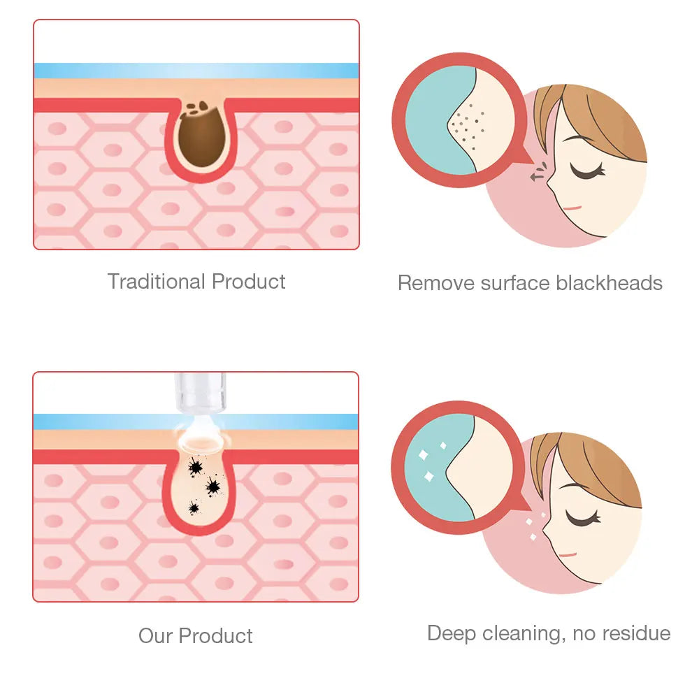 Digital Diamond Microdermabrasion Vacuum Blackhead Cleaner Facial Acne Marks Removal Machine Deep Cleaning Pores Skin Care Tool