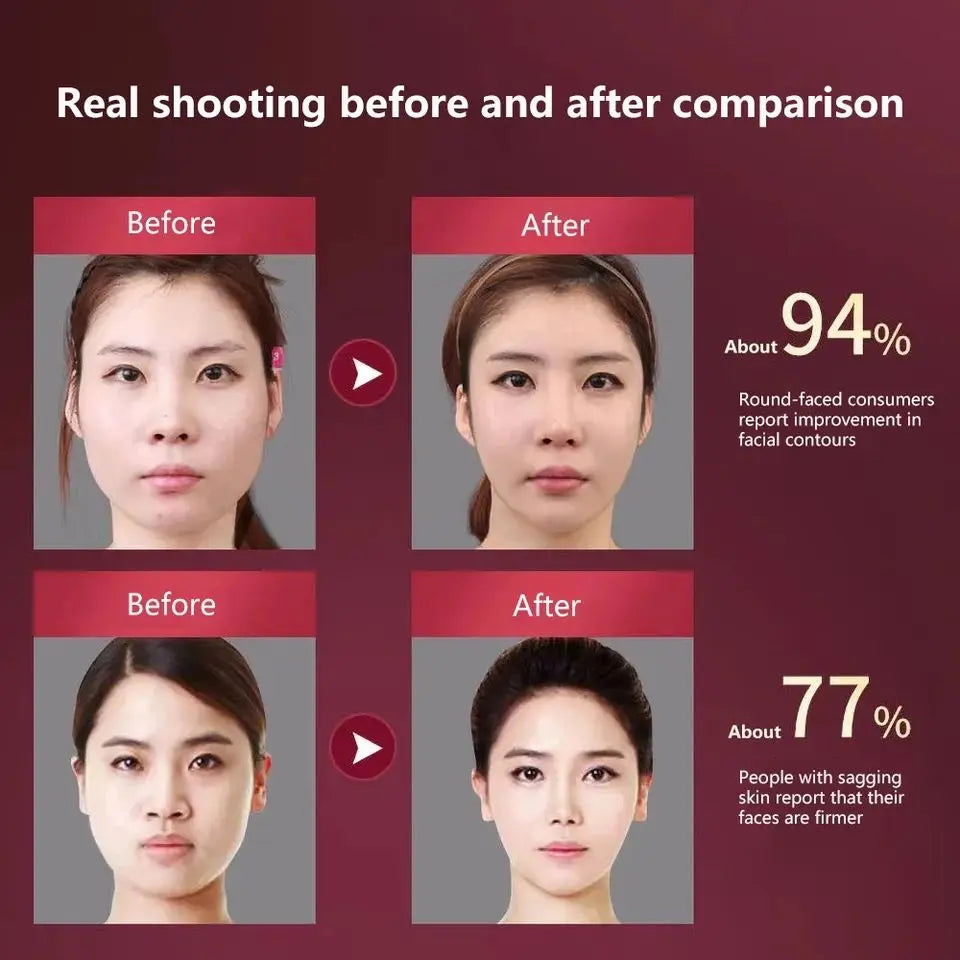 LED Facial Lifting Massager | V-Face Vibration Device