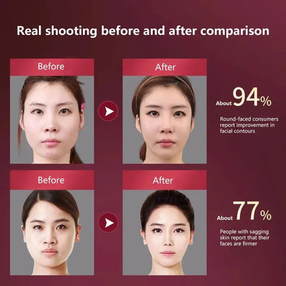 LED Facial Lifting Massager | V-Face Vibration Device