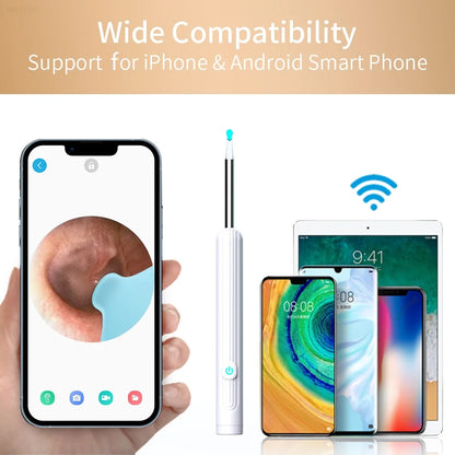 Smartphone with ear inspection app, device for ear inspection, and multiple smartphone screens on a white background.