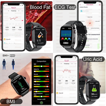 2025 Neue Mikro-Vorsorgeuntersuchung Smartwatch für Herren Harnsäure Körperfett Fünf-Organe-Gesundheitsuhr Bluetooth-Anruf Smart-Armband