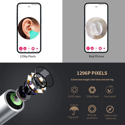 Smartphone app interface showing ear inspection with 1296P pixels, close-up of smartphone camera lens, and feature list on a dark background.