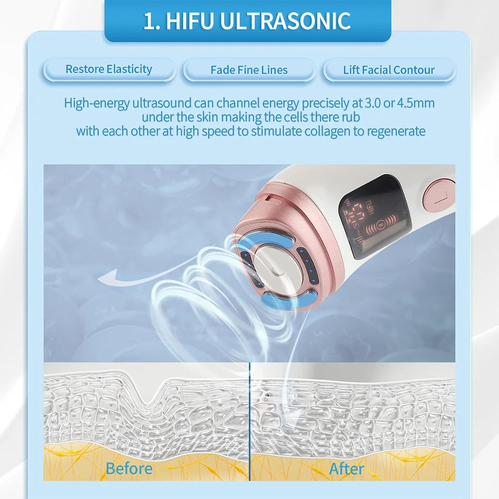 Mini HIFU Machine – Ultrasonic RF EMS Facial Lifting